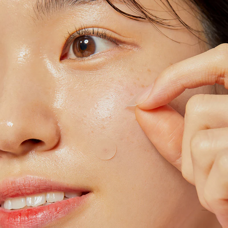 Acne Pimple Master Patches - Image 7